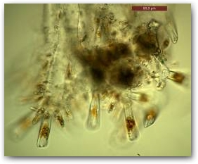 Концевые ветви древовидной колонии гомфонемы, толщина которых превосходит толщину клеток. На поверхности ветвей виден обильный оброст (микроэпифитон) из клеток ахнантидиума (Achnanthidium) на коротких “стебельках”.