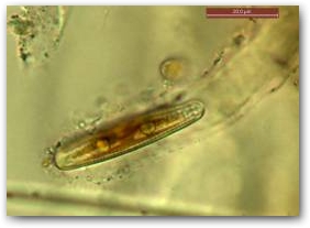 Клетка гомфонемы (Gomphonema) на конце ветви колонии, одетая в собственную капсулу.